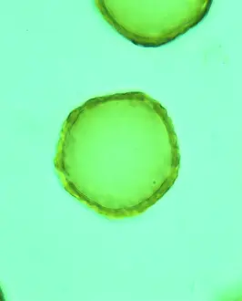 Pollen: Ulmus glabra, elm tree pollen