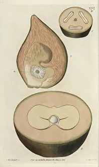 Unripe: Unripe fruit, sections of the double coconut