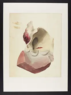 Untitled: Untitled (Heart Disease)