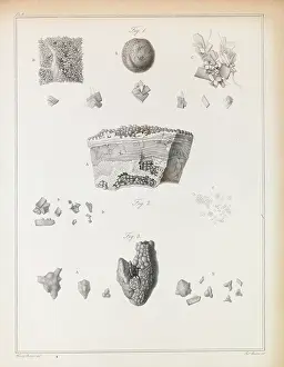 1828: Urinary stones