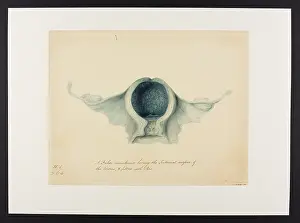 Filled: Uterus: False Membrane Lining