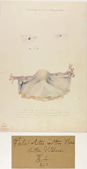 Bony: Uterus: Phlebolites