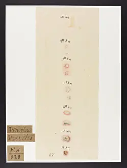 Blank: Variolus Vesicles