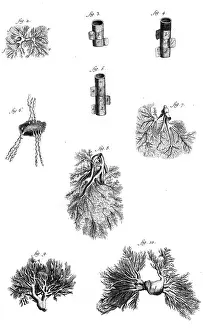 Examples: Various examples of veins and arteries of the human body