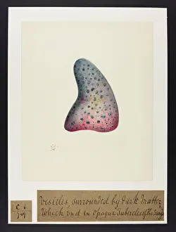 Lung: Vesicles Surrounded by Dark Matter