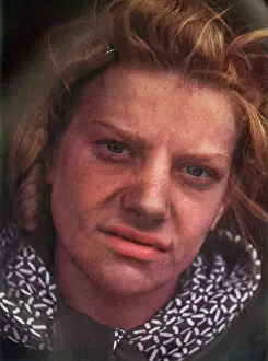 Home Front: A victim of an Air Attack