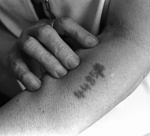 Burned: Victim of Auschwitz concentration camp, 1994