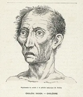 Epidemics: VICTIM OF CHOLERA/1883