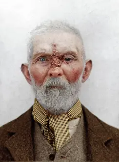Cursed: Victorian Asylum in Colour