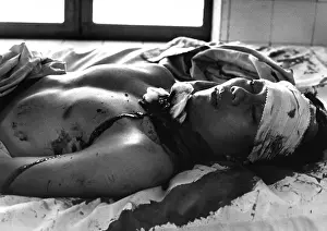 Proxy: Vietnam War. One of 48 persons wounded by ?