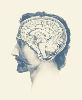 Showcasing: Side view of a male's brain, showcasing the venous