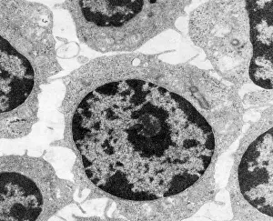 Microscopy: White Blood Cells in Leukemia