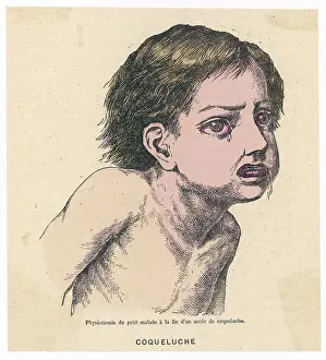 Whooping: WHOOPING COUGH/1883