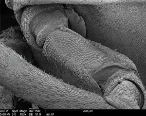 Woodlouse: Woodlouse antenna
