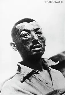Scarred: World War II