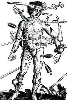 Stab: Wound Man, 1517