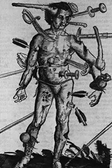 Authored: WOUND MAN. A man with wounds from many different ?