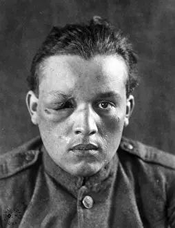 Dogface: WWI, Wounded Soldier