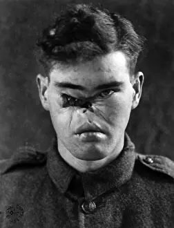 Dogface: WWI, Wounded Soldier