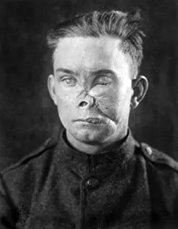 Dogface: WWI, Wounded Soldier