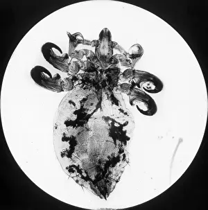 X Rays: X-Ray - Antelope Parasite