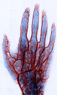 Xray: X-ray of Blood Vessels