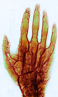 Normal: X-ray of Blood Vessels