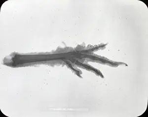 X Rays: X-Ray - Claw foot