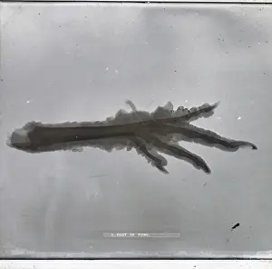 X Rays: X-Ray - Claw Foot