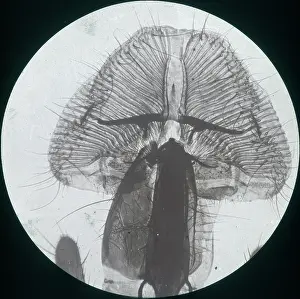 X Rays: X-Ray - Close-up X-ray view of a Blow Fly Proboscis