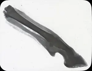X Rays: X-Ray - Foot of Lamb