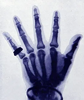 Halftone: X-Ray halftone presentation of a full hand with