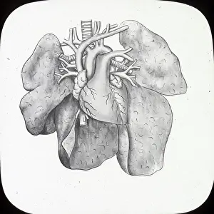 X Rays: X-Ray - Heart and Lungs