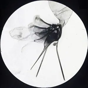 X Rays: X-Ray - Honey Bee Sting