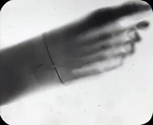 X Rays: X-Ray - Human Foot