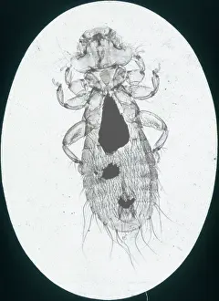 X Rays: X-Ray - Microscopic x-ray view of a small head louse