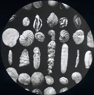 X Rays: X-Ray - Parasite Specimens