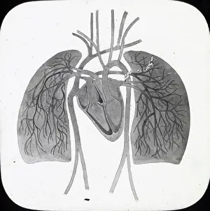 Pulmonary: X-Ray - Pulmonary Circulation