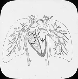 Pulmonary: X-Ray - Pulmonary Circulation