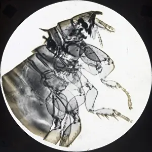 X Rays: X-Ray - Rabbit Flea