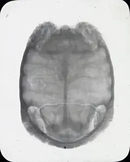 X Rays: X-Ray - Showing Skeleton of Tortoise