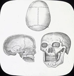 X Rays: X-Ray - Skull, Front, Top-and Section