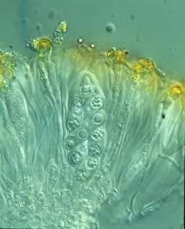 Spore: Xanthoria parietina, lichen